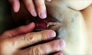 Eyethai SBA
