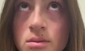 Public bathroom diarrhea