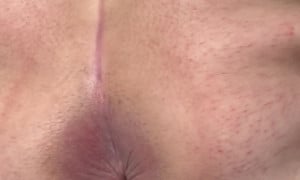 Farting sissyboy666