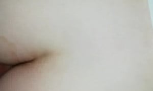 Figopertionosez
